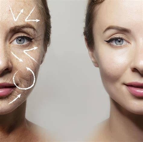 thermismooth alpharetta|Skin Tightening Alpharetta GA .